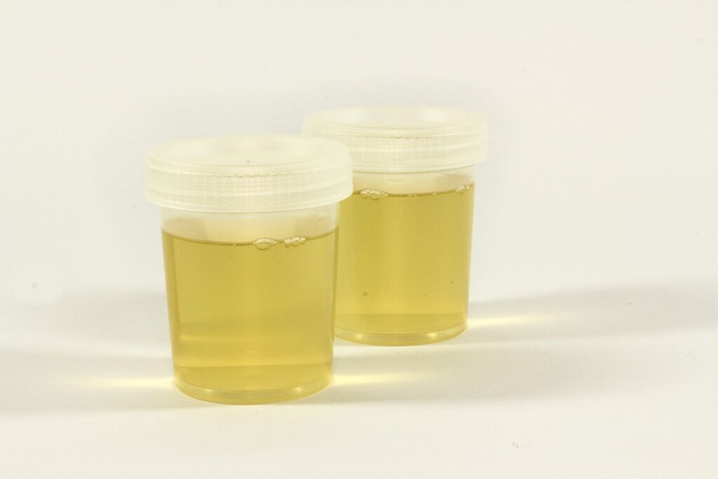how to use enzyme cleaner for cat urine
